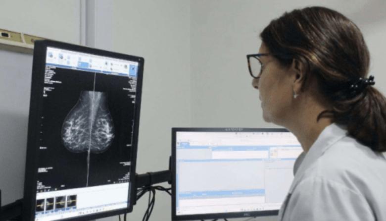 La Provincia comenzará a indicar la mamografía a los 40 años