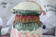 “Pehua Sonríe”: el programa municipal lleva casi mil prótesis dentales entregadas